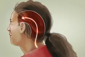 后脑勺痛，眼眶痛，担心大脑有问题？其实是枕神经痛图片