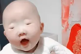 产妇生出“没眼”娃，医生检查后却哭笑不得，网友：翻版李荣浩？图片