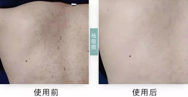 小包装身体乳