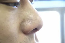 维生素E真的能去黑头吗？说实话，补充维生素E的好处其实是这些图片