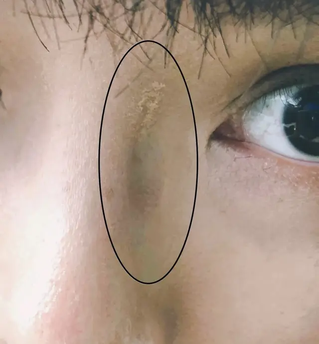 如何根据脸型选眼镜？方形还是圆形？搭配好眼镜，让你气质更出众