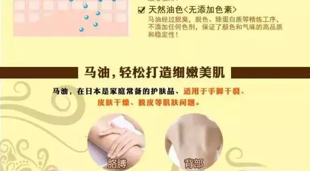 银屑病能用什么身体乳