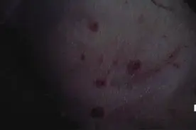 最近猪身上长红点，红疙瘩的太多了，快来看看怎么区分这种病图片