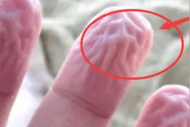 为什么有的人洗碗，手指在水里泡不到十分钟，就会起皱呢？图片