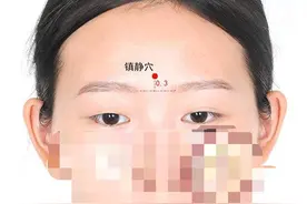中医健康养生之人体头部穴位镇静穴图片
