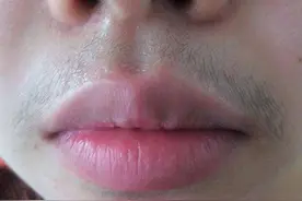 女性竟然也长小胡子？祸根是什么？长出的胡子可以剃掉吗？图片