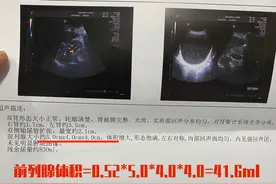 彩超提示前列腺增生，但没有临床症状，这时候需要治疗吗？图片