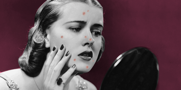 火爆INS的芝士皂，洗脸就像敷面膜，痘痘，黑头，螨虫全都消失了