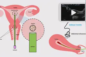 试管移植前的这些激素值——你都达标了吗？图片