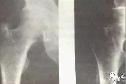 胯松开了，原来是这个样子图片