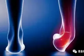 骨头响是什么原因？尾椎骨疼怎样快速缓解？图片