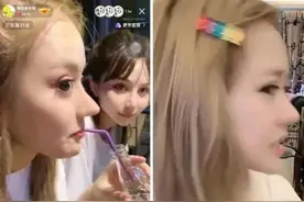 蛋蛋整容失败，直播侧脸照，鼻型怪异难接受。图片