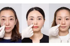 小茂最强肌诊室|美白淡斑，护肤品能做到什么程度？图片