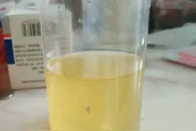 中医治疗“脾虚气弱”1例，男，42岁，脾虚，小腹下坠，尿浊白图片
