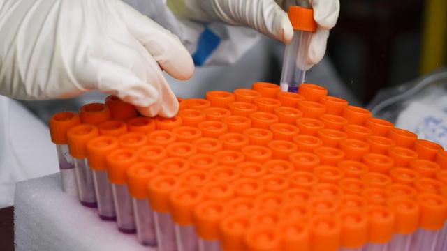 日照五莲确诊病例与国内近期聚集性疫情毒株序列高度同源 属同一传播链