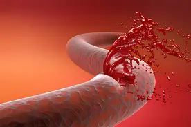 痔疮出血怎么办？一洗二躺三用药，少了哪个都不行图片