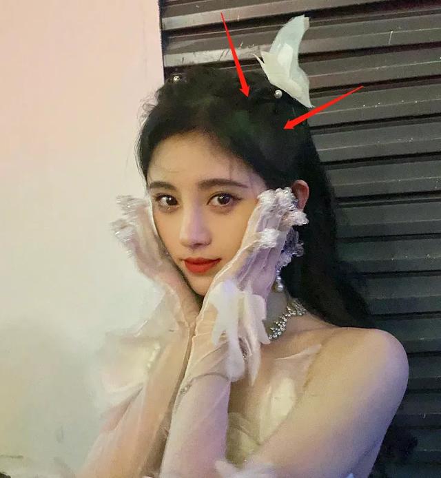 耳朵前鬓角下鸡皮疙瘩红印 耳朵前鬓角下鸡皮疙瘩红印