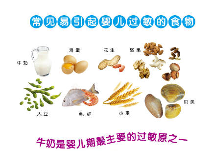 母乳喂养的宝宝长湿疹怎么办