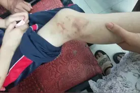 南安：长期虐打11岁女儿，恶毒后妈被判两年三个月图片