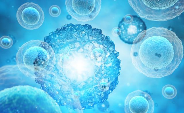 全球已有约120个 CDS病例被报道，它是由 ABHD 5基因突变导致的