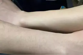 为什么有的女性体毛旺盛，有的“光秃秃”的？这是什么原因呢？图片