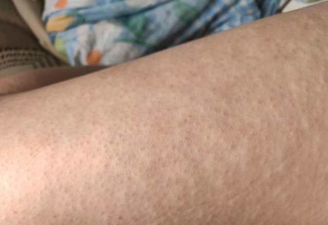 凡士林粉瓶身体乳会长毛