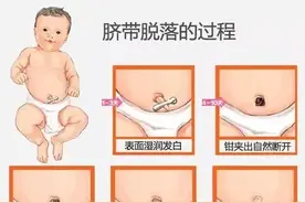 新生儿“脐带护理”很重要，事关宝宝健康，这些护理知识要牢记图片