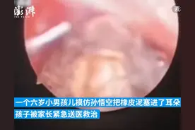 男孩往耳朵塞橡皮泥、笔头、塑料片，医生边取边劝：你不是孙悟空图片