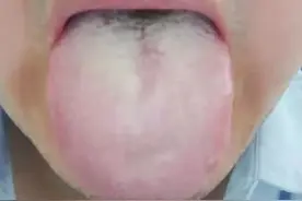 动一动就大汗淋漓是气虚吗？3种大汗淋漓的情况一次让你看明白图片