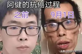 #健康中国行动2030# 由抗癌博主阿健所想到的——结直肠癌的“前世今生”图片