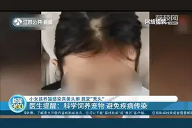 女孩养猫感染真菌头癣变“秃头”，医生：科学养宠物，避免传染病图片