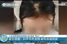 女孩养猫感染真菌头癣变“秃头”，医生：科学养宠物，避免传染病图片