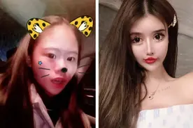 14岁开始整容，2年动刀380次费用高达400万，妈妈是推手图片