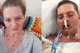 澳女子生怪病，舌头变黑呼吸困难满身皮疹，濒死时医生才找出病根图片