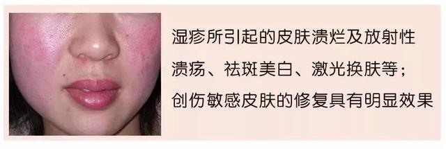 美肌冻干粉有什么作用 美肌冻干粉有什么作用和功效