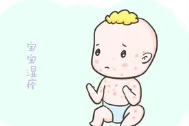 小宝宝为什么容易得宝宝湿疹？做好这几样就不用害怕了图片