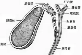 正视听：你真的以为胆结石摘胆就好？图片