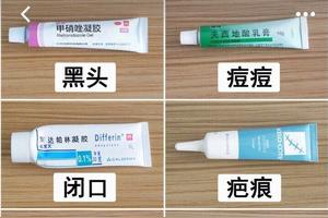 脸上有痘痘的看过来!很齐全的药膏快来码住图