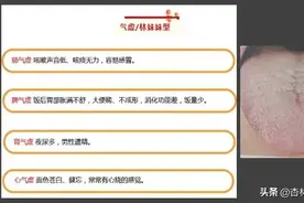 气虚、血虚、阴虚、阳虚？教你一分钟辨别图片