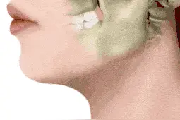 张不开口、挂钩疼，怎么办？图片