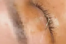 男朋友钓鱼，女朋友上钩！离出事只差几毫米，差点连它都保不住图片