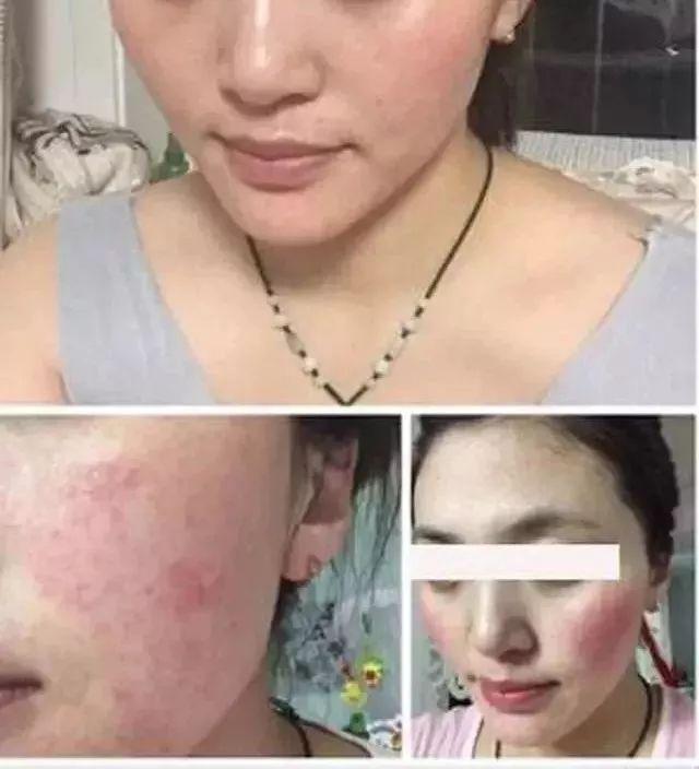 冻干粉是什么，有什么作用?如何正确使用？你想知道的都在这里了