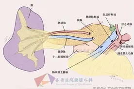 56岁女性大便中可见“油花”，原来是得了这种病图片