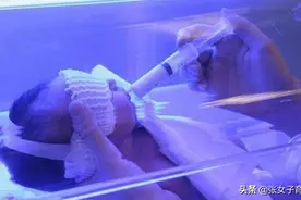 宝宝出生后，成了“小黄人”，可能与宝妈孕期这几个坏习惯有关图片