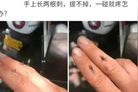 手上长了两根硬刺，请问去医院应该挂什么科？拔不掉一碰就痛图片