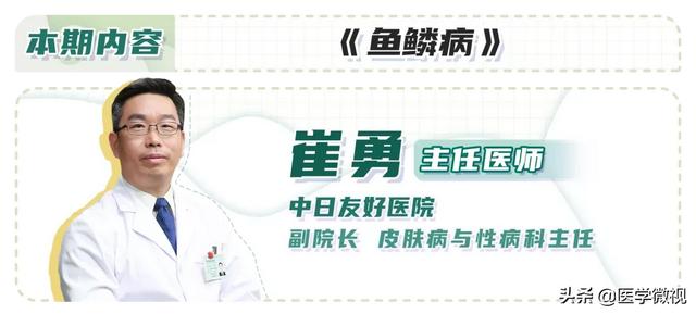 我的x性连锁鱼鳞病经历