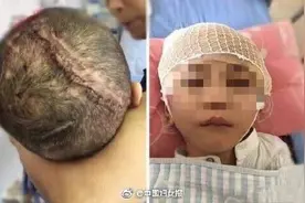 男童被继母虐待成植物人，生父被以虐待罪及遗弃罪起诉图片