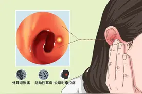 丨耳鼻喉诊室丨耳疖疼痛 针灸显奇效图片