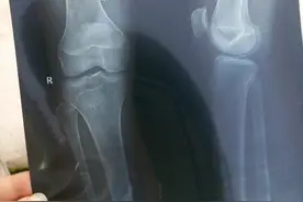 孩子总是长不高，原来父母经常给孩子吃这个药，也许你也做过图片