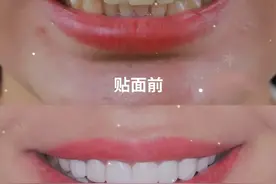 “美白牙齿”骗局，还要坑多少人？图片